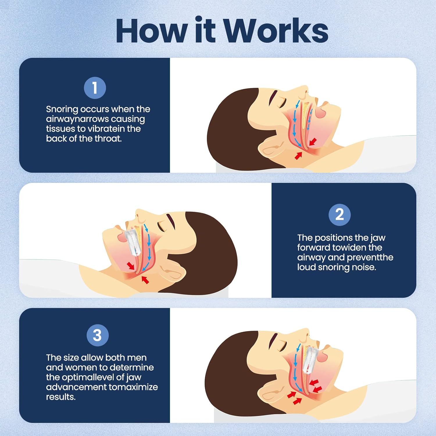 Raxiva-anti snoring mouth guard for sleep apnea