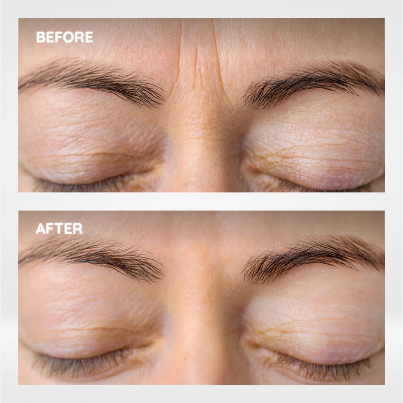 Raxiva microcurrent facial roller